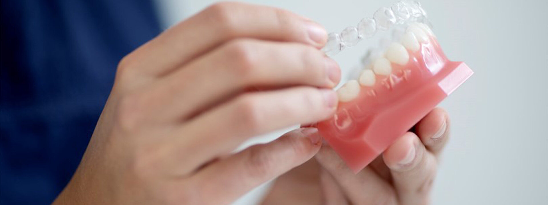 Invisalign skinne på tænder