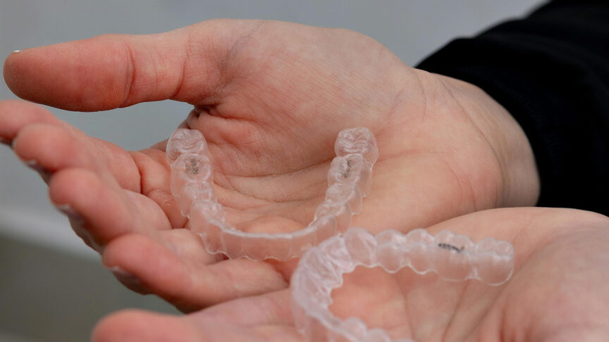 hvem-kan-faa-invisalign