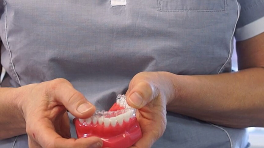 invisalign-skinne_colosseum_tandlægerne
