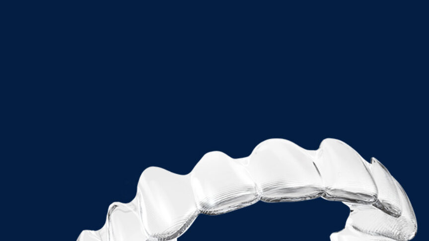 invisalign_skinne_colosseum